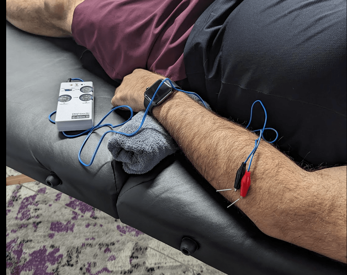 Pickleball Pain? Here’s How Physical Therapy Can Keep You in the Game